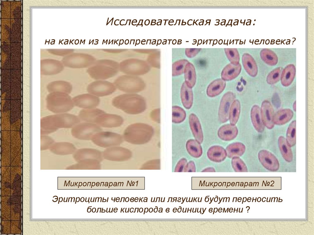 Рассмотрите микрофотографии 1 и 2 с изображением эритроцитов человека и лягушки