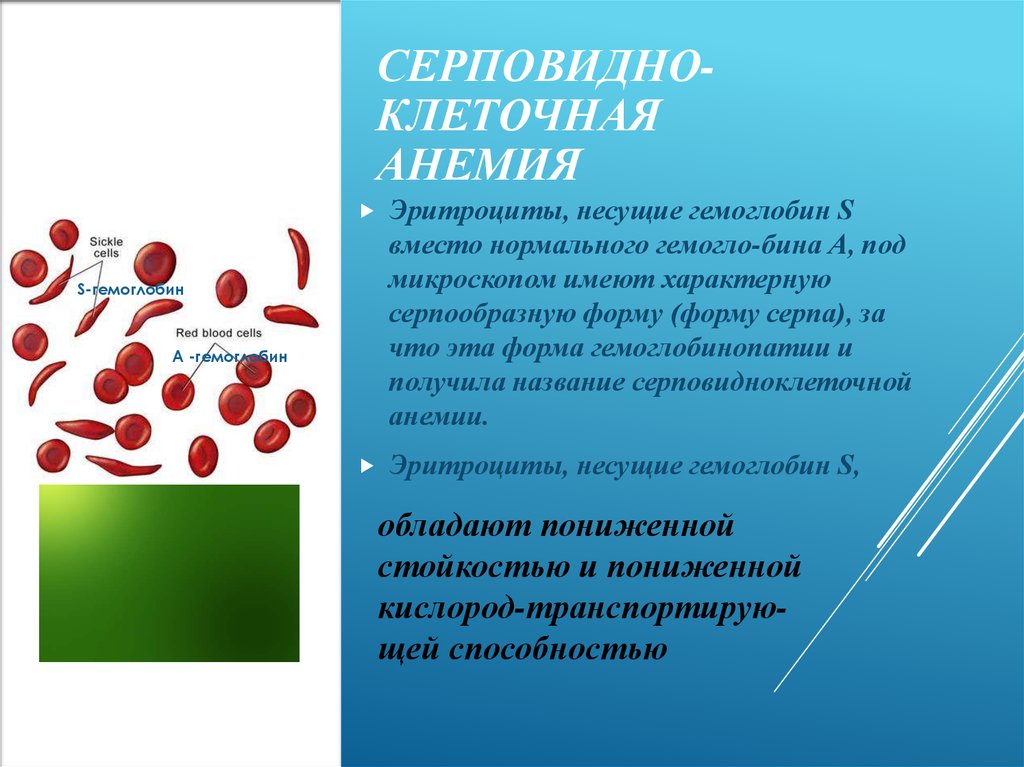 Эритроциты при серповидно клеточной анемии