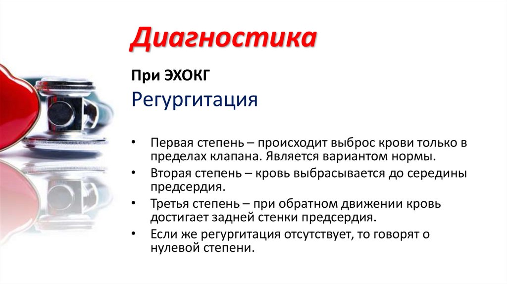 Пролапс митрального клапана с регургитацией 2 степени