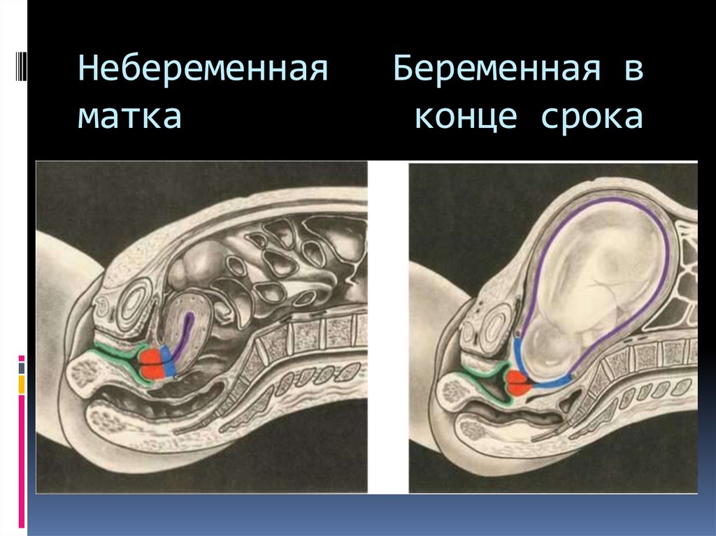 Концы матки