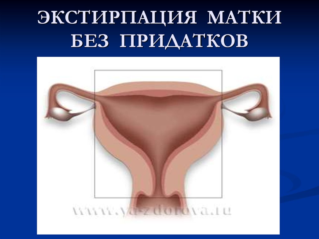 Презентация экстирпация матки