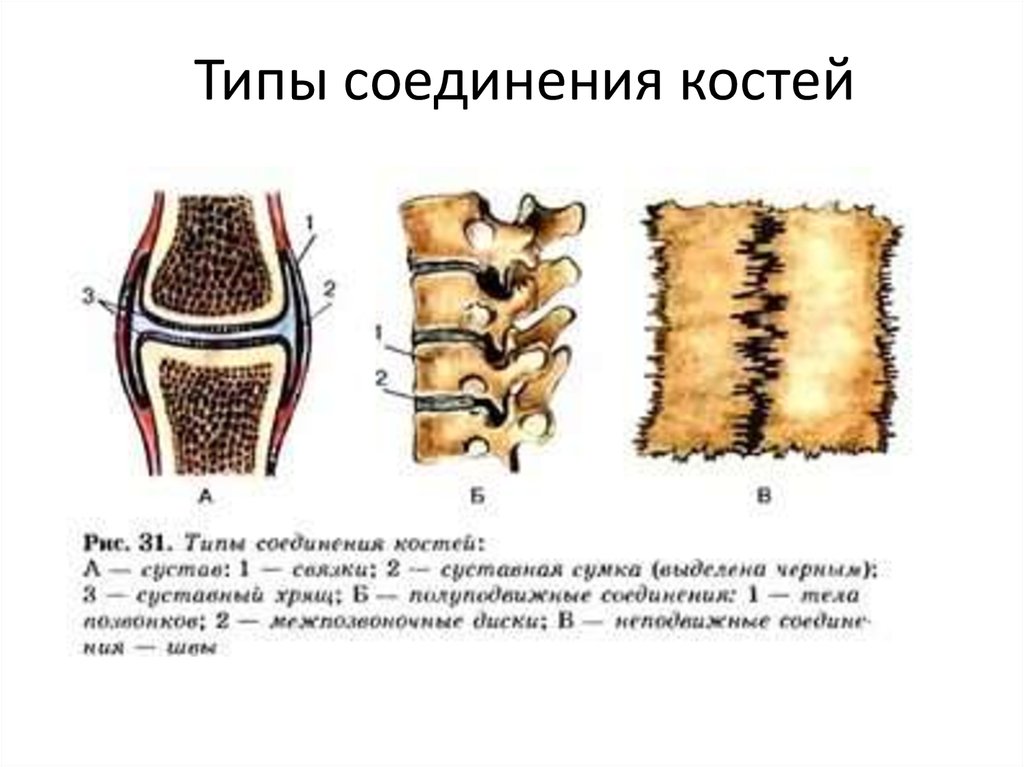 Типы соединения костей