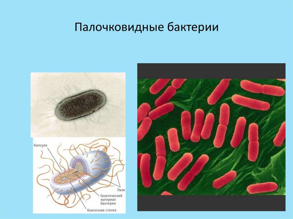 Палочковидные бактерии. Палочковидные бактерии вибрионы. Палочковидные бактерии микробиология бациллы. Палочковидные по форме бактерии называются. Палочковидные формы бактерий.