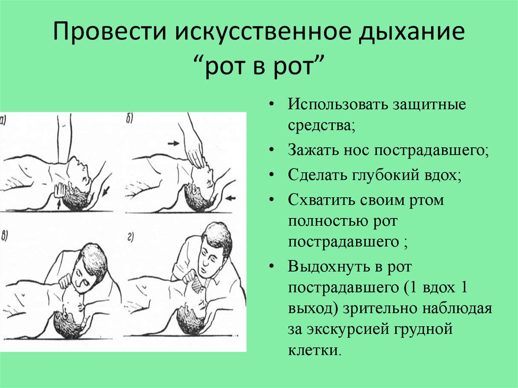 Техника искусственного. Искусственное дыхание рот в рот алгоритм. Искусственное дыхание методом рот к носу. Схема оказания искусственного дыхания. Искусственное дыхание способы схема.