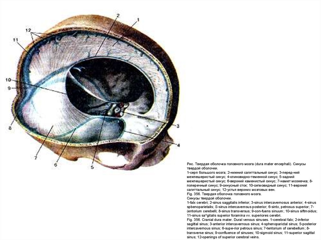Твердо мозговая оболочка. Сигмовидный синус твердой мозговой оболочки. Серп большого мозга (твердая оболочка головного мозга). .Dura Mater encephali твердая мозговая оболочка. Мозговые оболочки головного мозга топографическая анатомия.