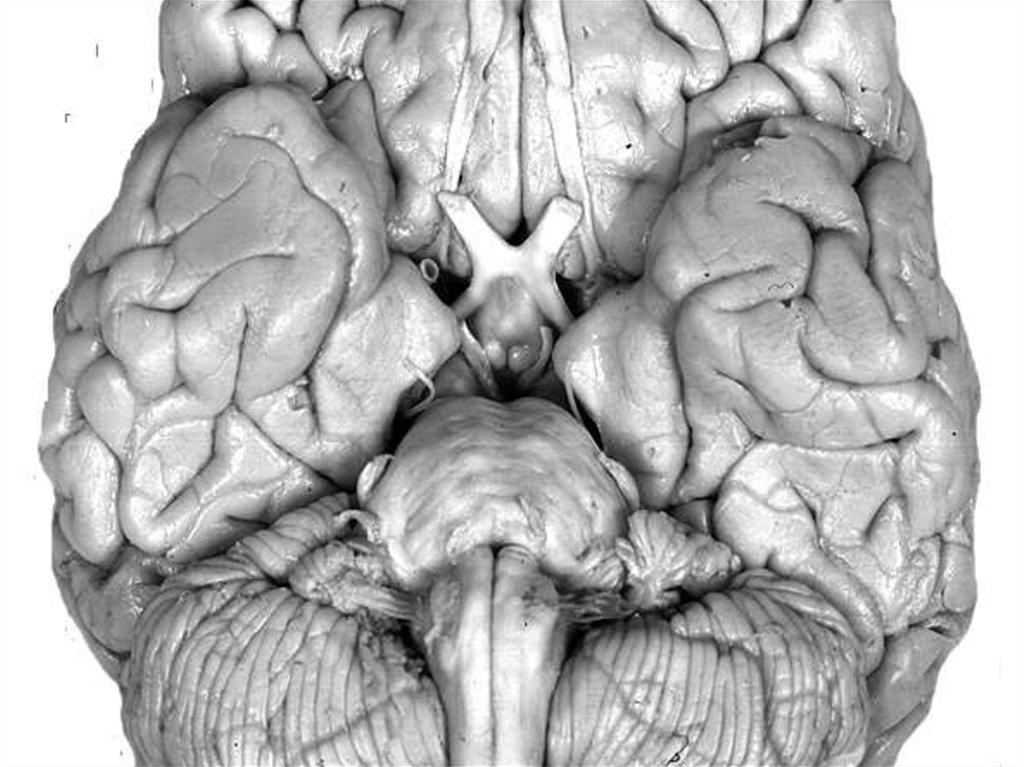 Поверхность головного мозга имеет. Базальная поверхность головного мозга. ЦНС анатомия. Складчатая поверхность головного мозга.