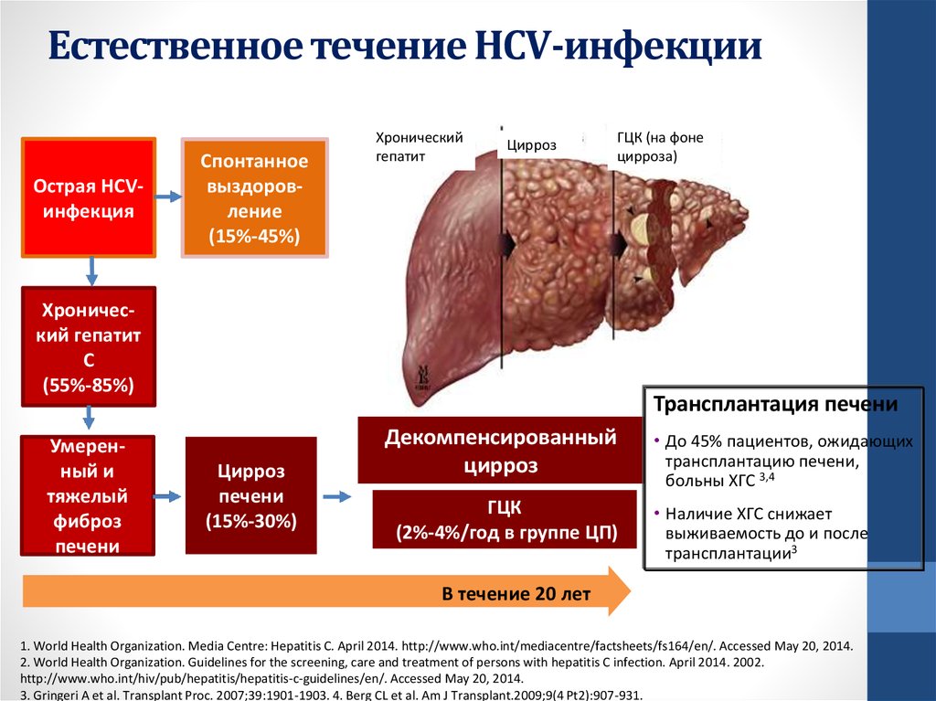 Остром гепатите