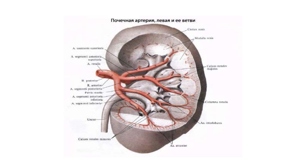 Правая почечная артерия. Солитарная почечная артерия. Нижнеполюсная почечная артерия. Добавочная почечная артерия. Добавочная почечная артерия и гидронефроз.