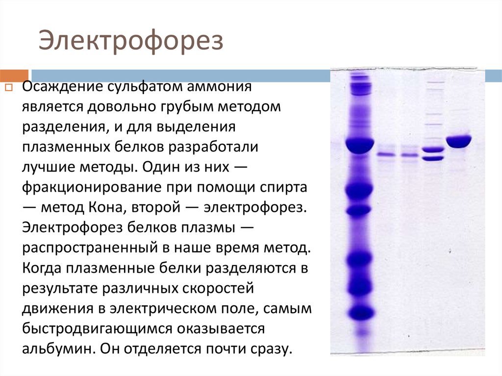 Электрофорез белков