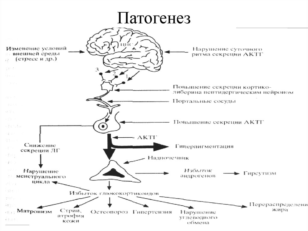 Патогенез гб. Патогенез ГБ схема. Механизм развития гипертонического криза. Патогенез гипертонического криза. Симпатоадреналовый гипертонический криз патогенез.