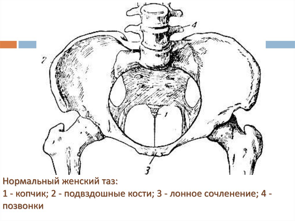 Нормальный женский таз: 1 - копчик; 2 - подвздошные кости; 3 - лонное сочленение; 4 - позвонки