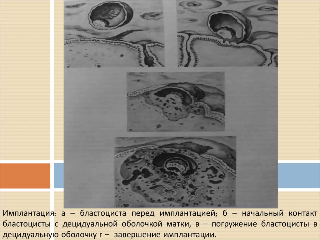 Имплантация беременность. Имплантация бластоцисты. Имплантация бластоцисты в матку. Имплантация бластоцисты в эндометрий. Стадии имплантации бластоцисты.