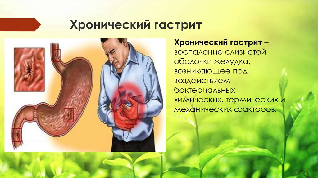 Роль гастрита. Хронические болезни желудочно-кишечного тракта. Хронические болезни ЖКТ. ЖКТ хронический гастрит.