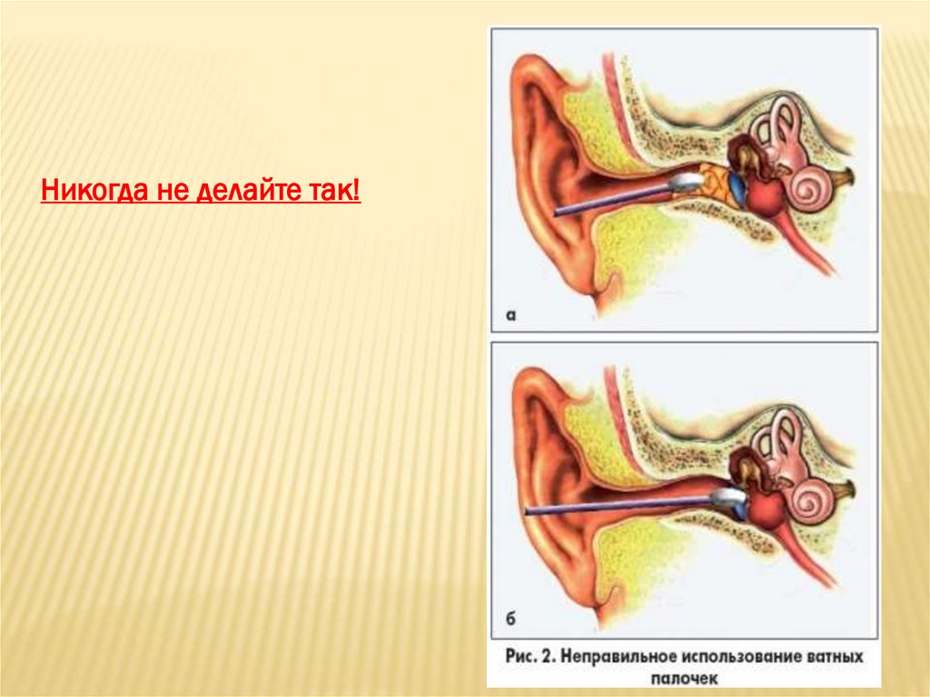 Гигиена слуха презентация