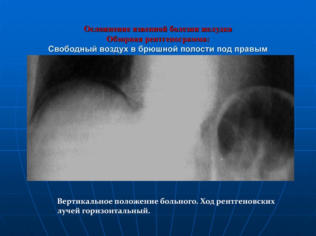 Лучевая диагностика брюшной полости презентация