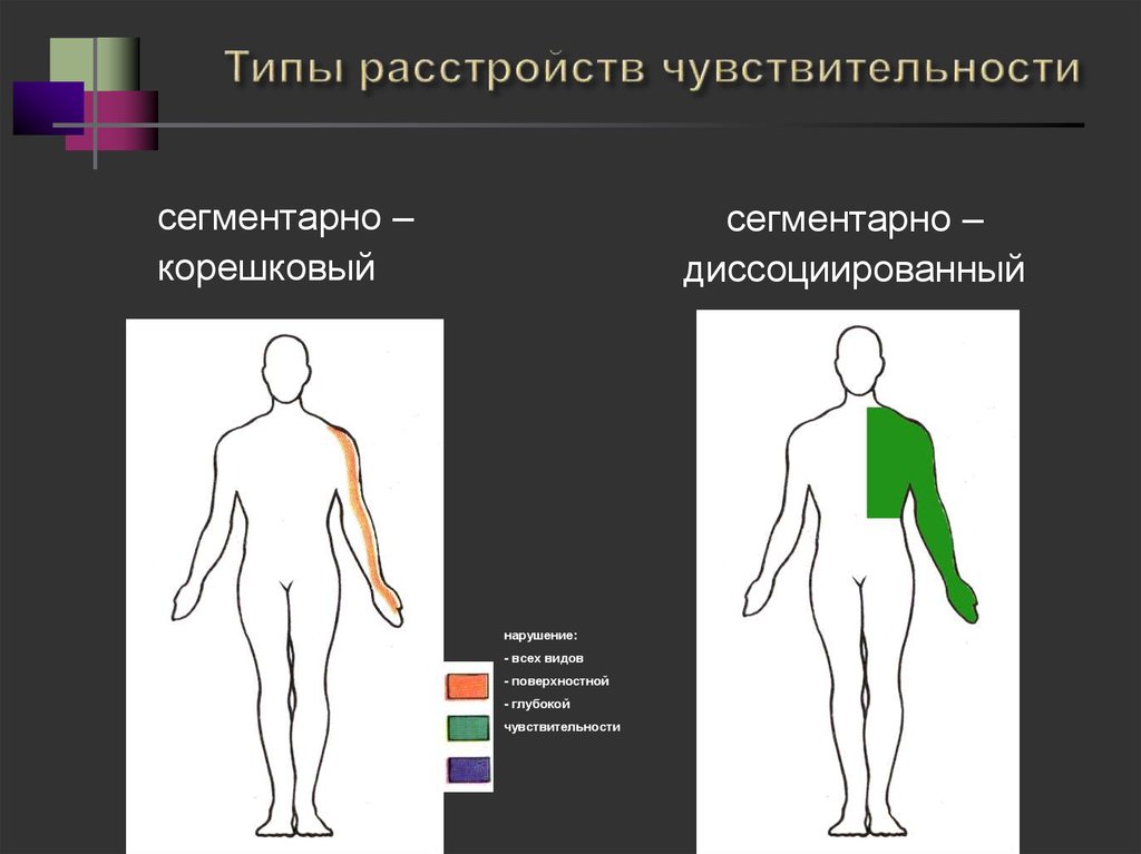 Нарушение ч. Сегментарный диссоциированный Тип расстройства чувствительности. Типы расстройств чувствительности неврология. Альтернирующий Тип расстройства чувствительности. Чувствительность нарушения чувствительности неврология.