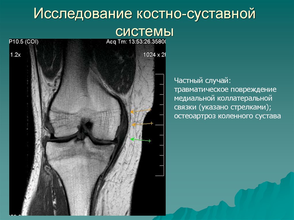 Методы исследования костно мышечной системы презентация