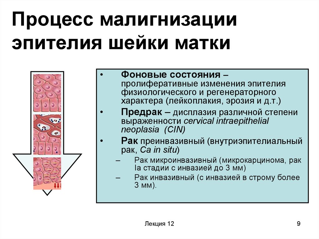 Реактивные изменения шейки. Этапы малигнизации плоского эпителия шейки матки. Лейкоплакия шейки матки. Малигнизация и гиперплазия.