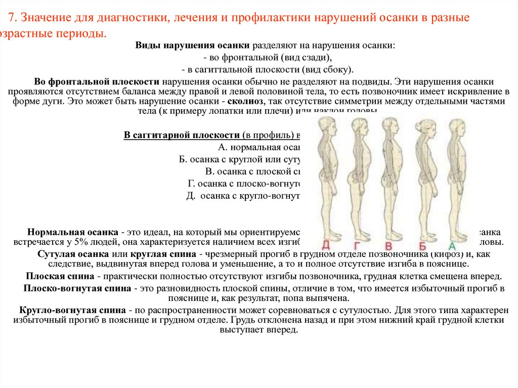 Виды нарушения осанки профилактика нарушений