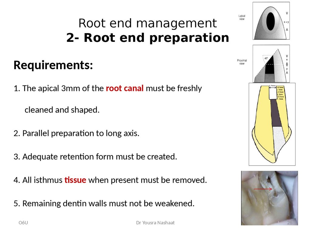 Endodontic Surgery Prezentaciya Onlajn