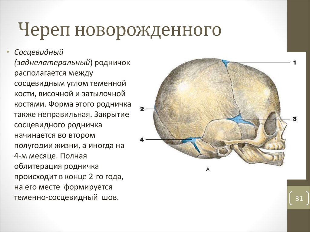 Соединение лобной и теменной кости. Кости черепа новорожденного роднички. Швы и роднички черепа анатомия. Швы черепа анатомия у новорожденных. Роднички новорожденного анатомия черепа.