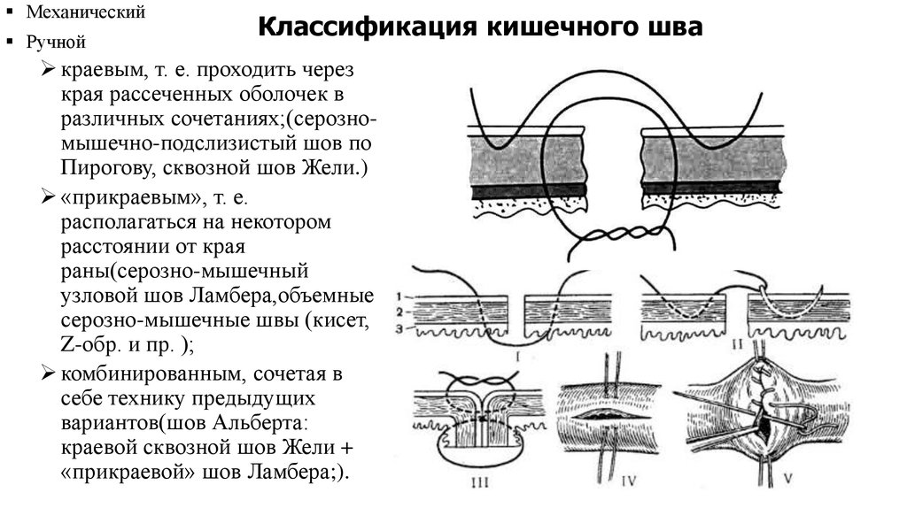 Несостоятельность послеоперационного шва карта вызова