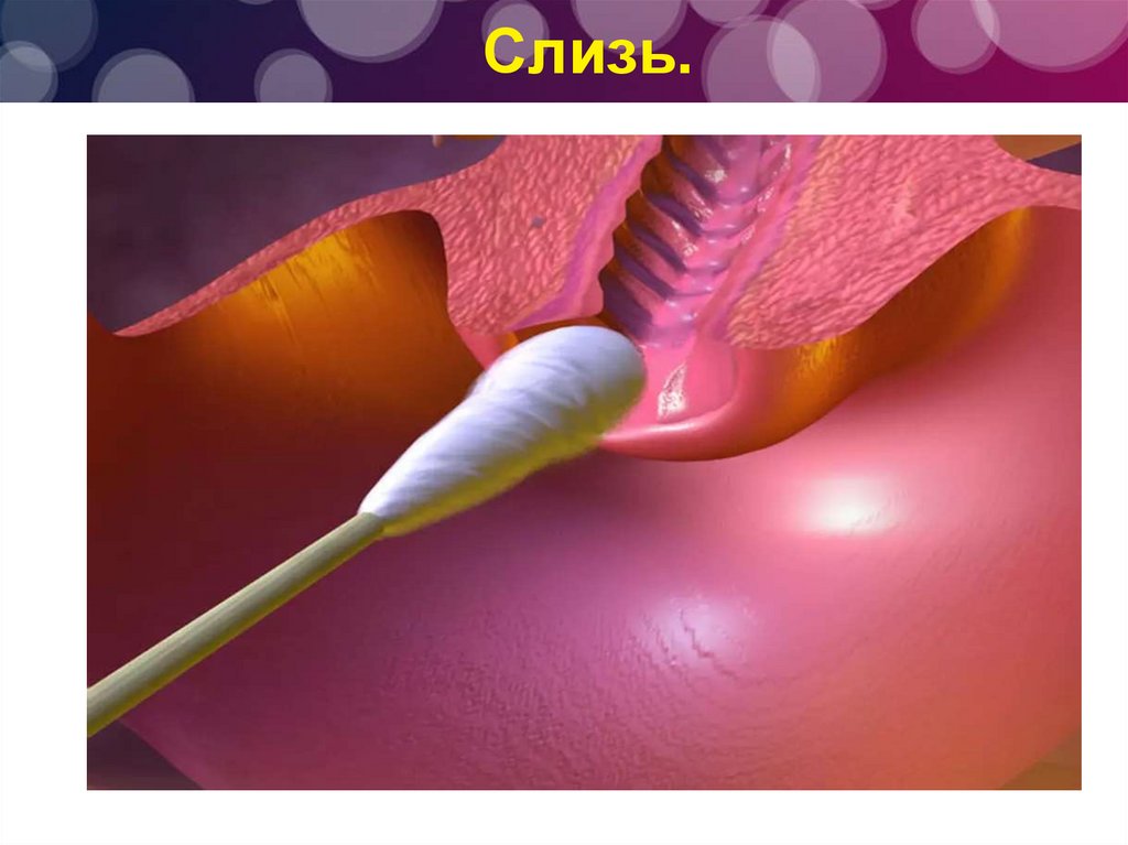 Мазок - презентация онлайн