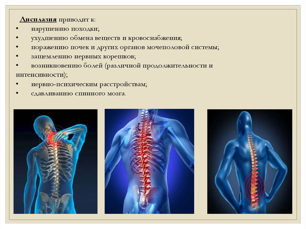 Презентация про позвоночник