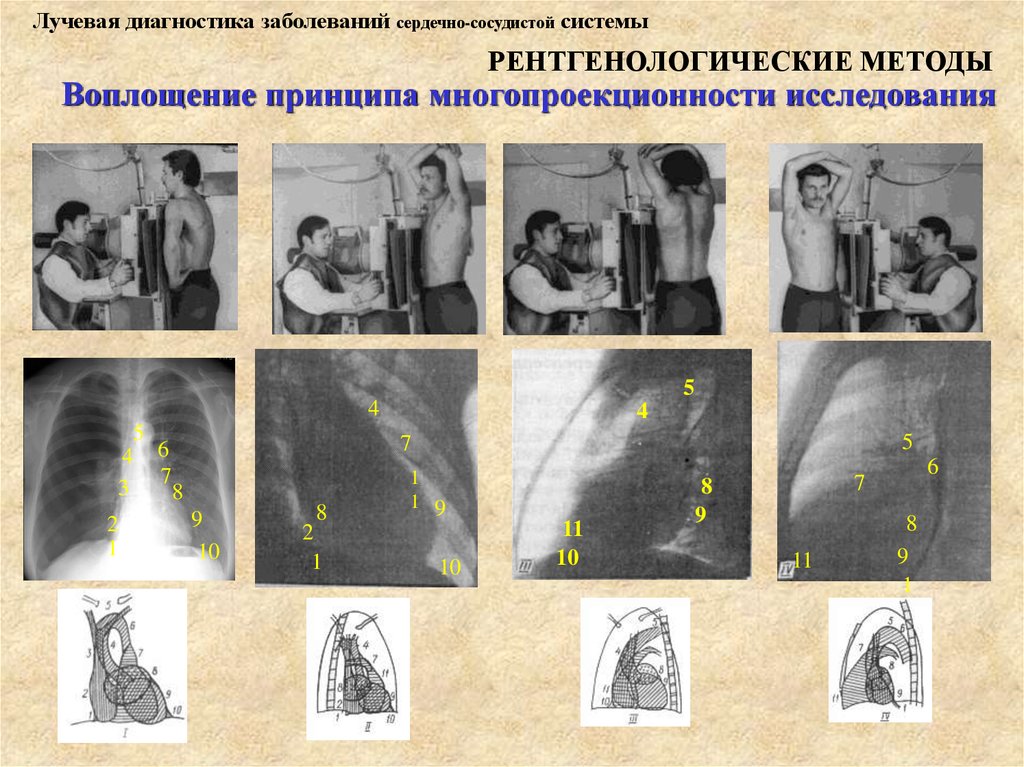 Диагностика нарушений. Лучевая диагностика заболеваний сердечно-сосудистой системы.. Лучевая диагностика при заболеваниях сердечной системы. Диагностика лучевой болезни. Методы лучевой диагностики рентгенологические.