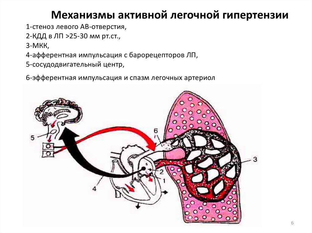 Патогенез митральной недостаточности схема