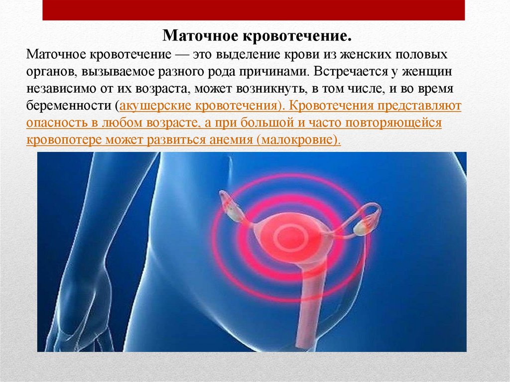 Почему кровит после полового акта у женщин. Профилактика маточных кровотечений. Маточное кровотечение причины. Прорывное маточное кровотечение.