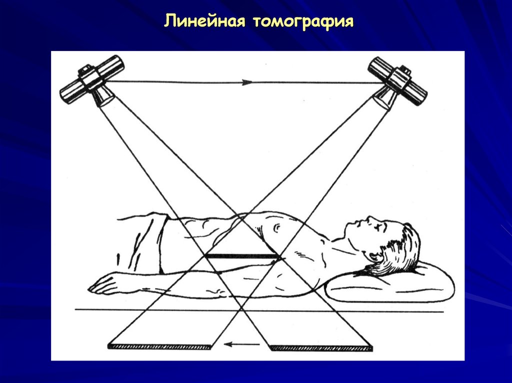 Диагностические возможности рисунка