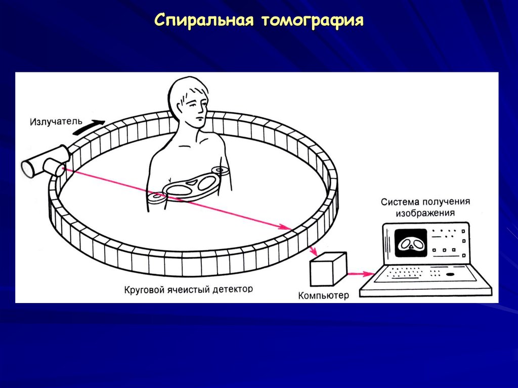 Схема получения изображения кт