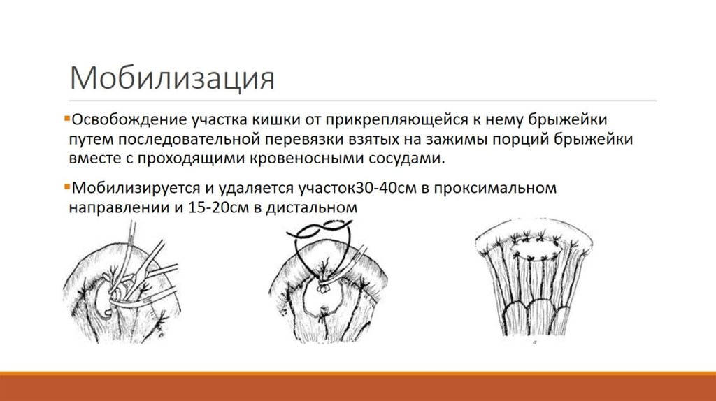 Мобилизация