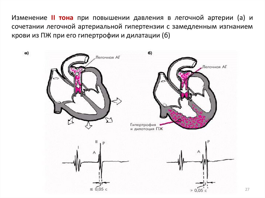 Легочное давление. Повышение давления в легочной артерии. Повышение давления в легочной артерии причины. Изменение давления в легочной артерии. Давление в легочной артерии повышено.