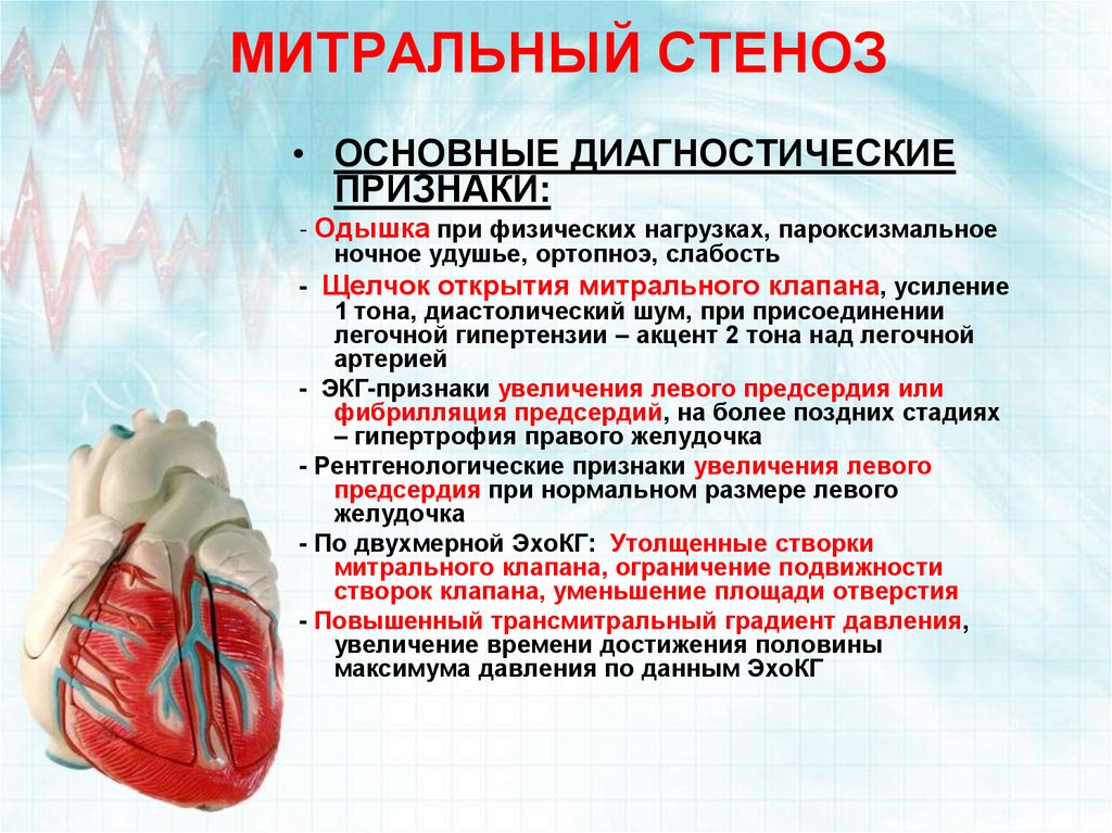 Осложнения стеноза. Приобретённый порок сердца стеноз митрального клапана. Митральные пороки сердца. При стенозе митрального клапана. Митральный порог сердца.