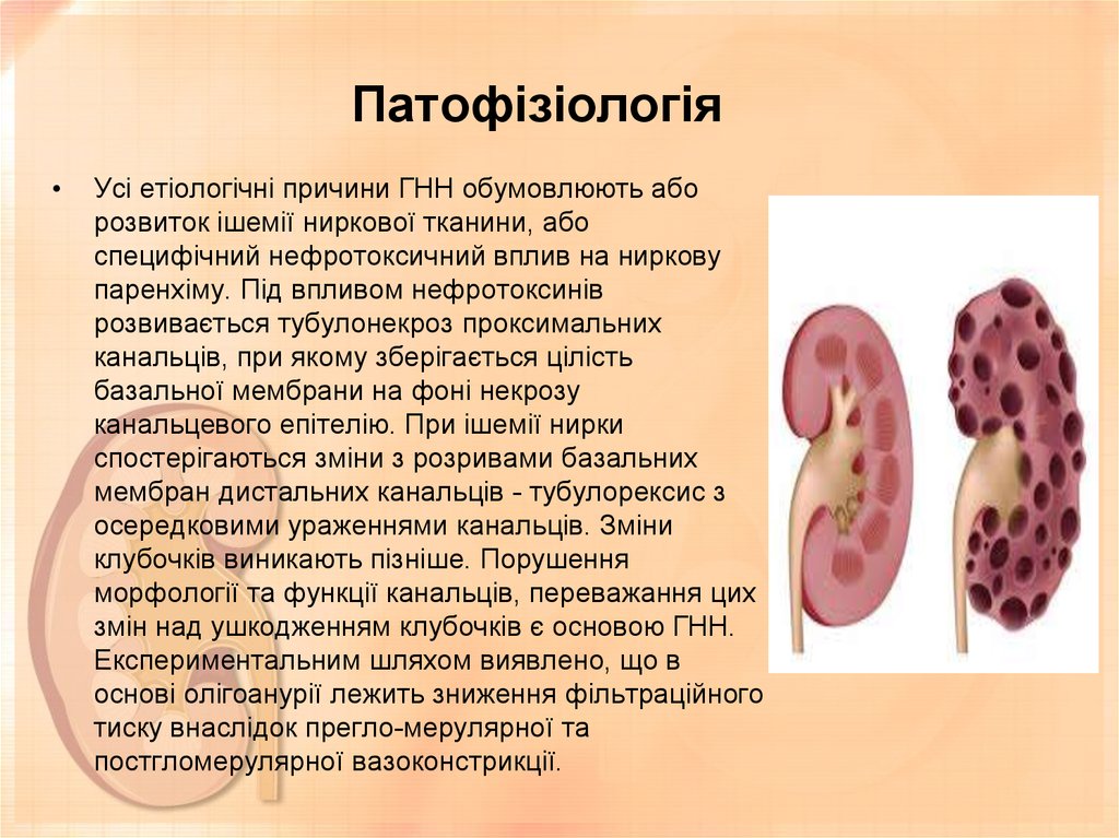 Патофізіологія