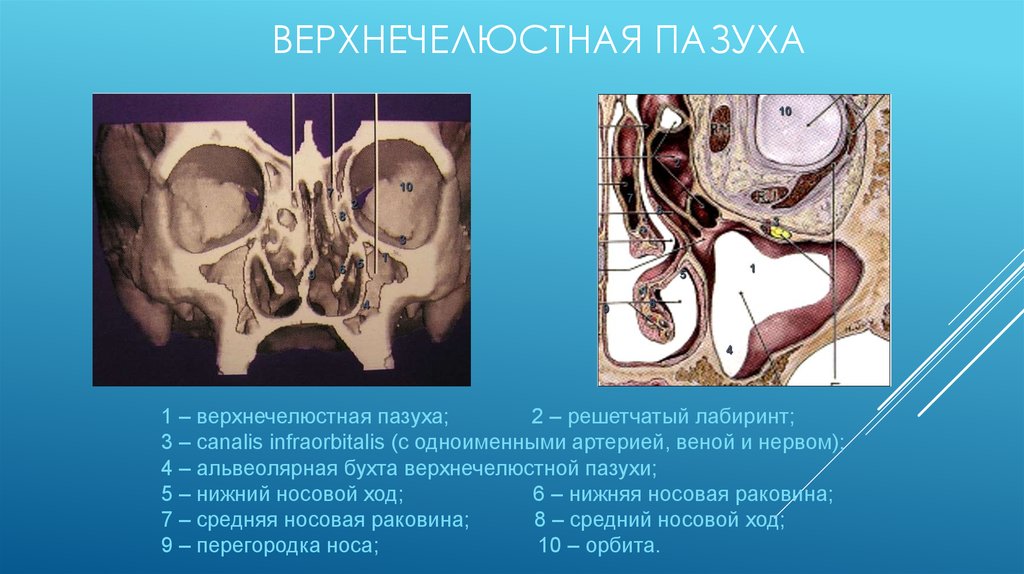 Верхнечелюстная пазуха киста где находится фото