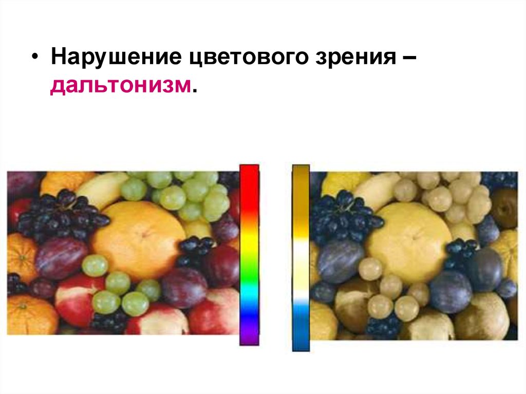 Нарушение цветного зрения. Причины нарушения цветового зрения. Нарушение цветового восприятия. Врожденные нарушения цветового зрения. Формы нарушения цветового зрения.