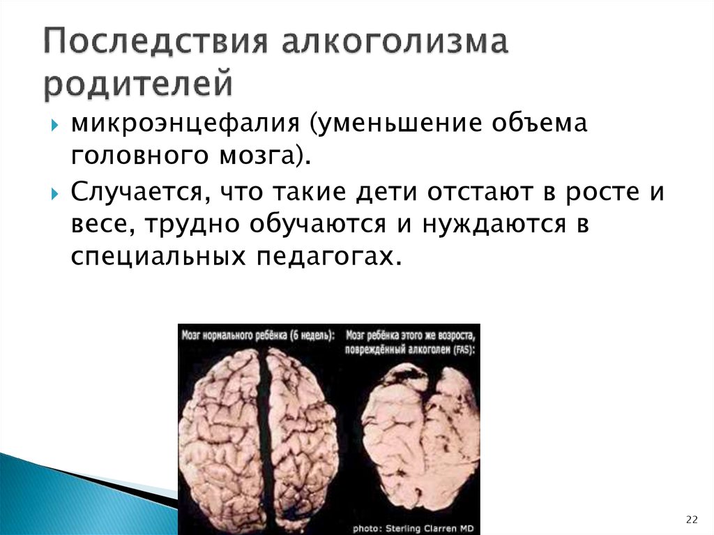 Следствие последствие. Последствия алкоголизма. Осложнения алкоголизма. Осложнения алкогольной зависимости.