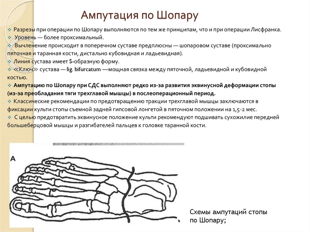 Шопара и лисфранка