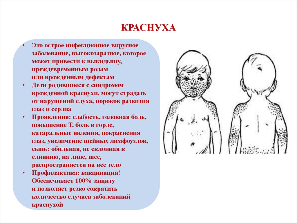 Какие симптомы у детей. Сыпь при краснухе у детей. Сыпь при корь краснуха. Сыпь краснуха краснуха сыпь. Митигированная краснуха.