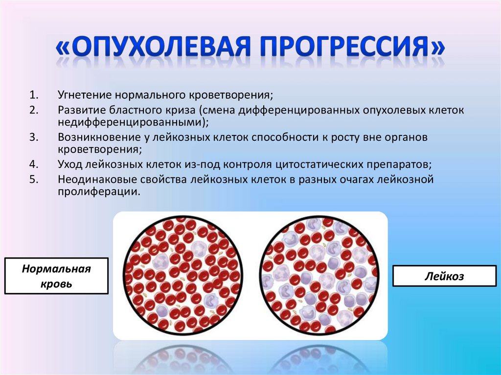 Опухолевая прогрессия презентация