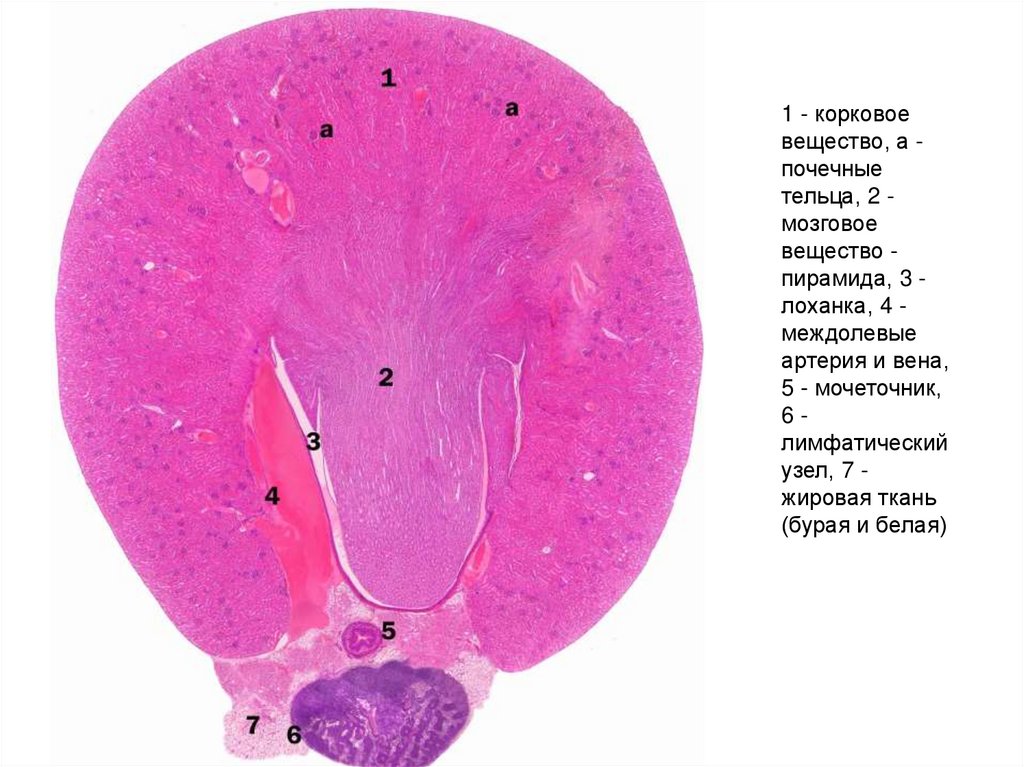 Почках и в головном мозге. Почечная лоханка гистология. Корковое вещество почки гистология. Корковое и мозговое вещество почки гистология. Чашечка почки гистология.