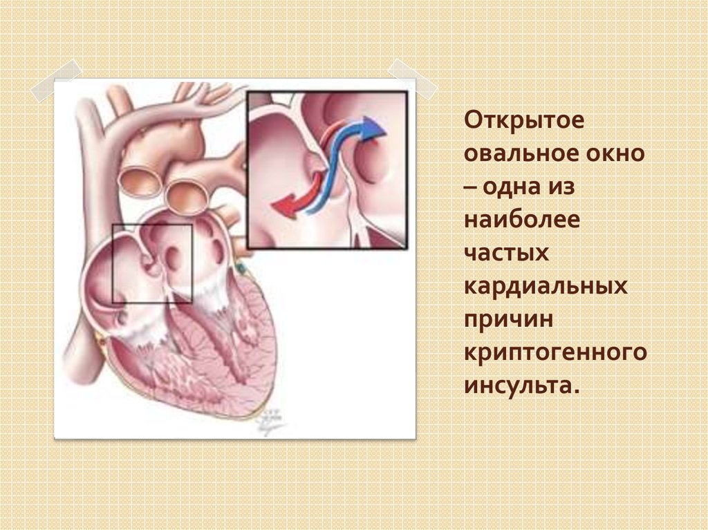 Овальное окно фото у ребенка