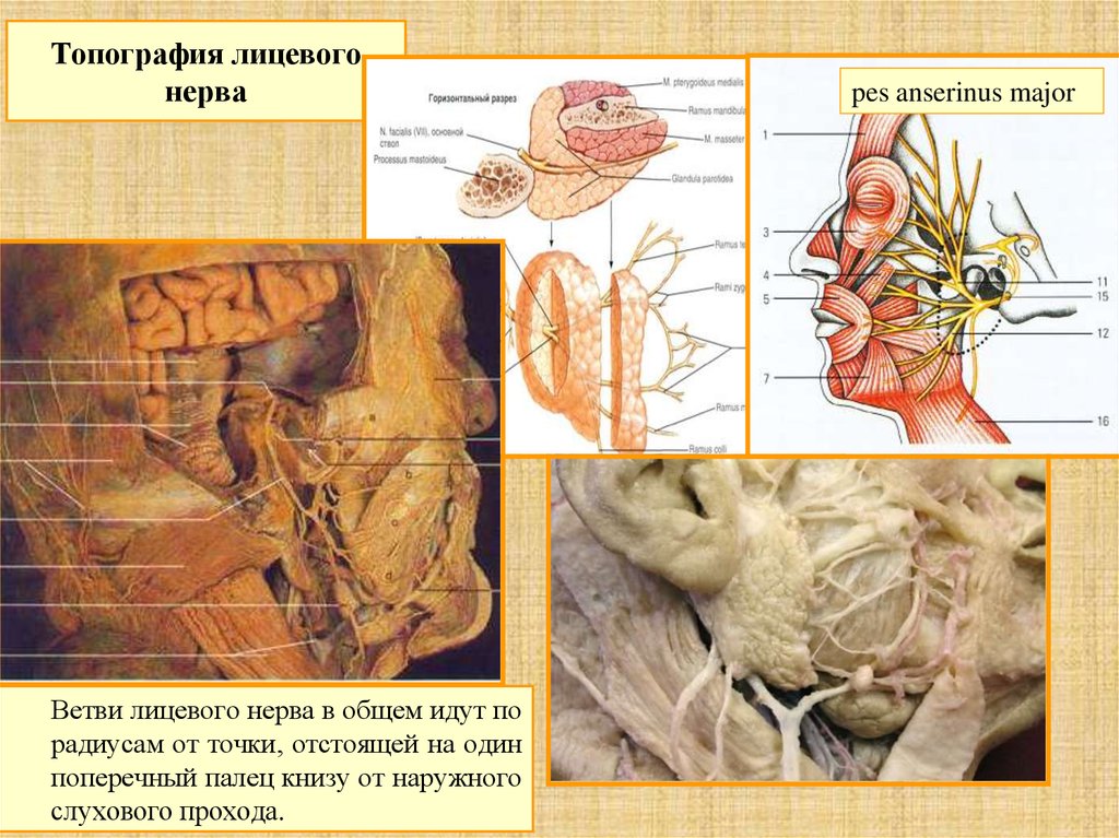 Лицевой нерв является. Лицевой черепно мозговой нерв. Лицевой нерв (промежуточно-лицевой нерв VII пара). Внечерепной отдел лицевого нерва. Черепно лицевые нервы анатомия.