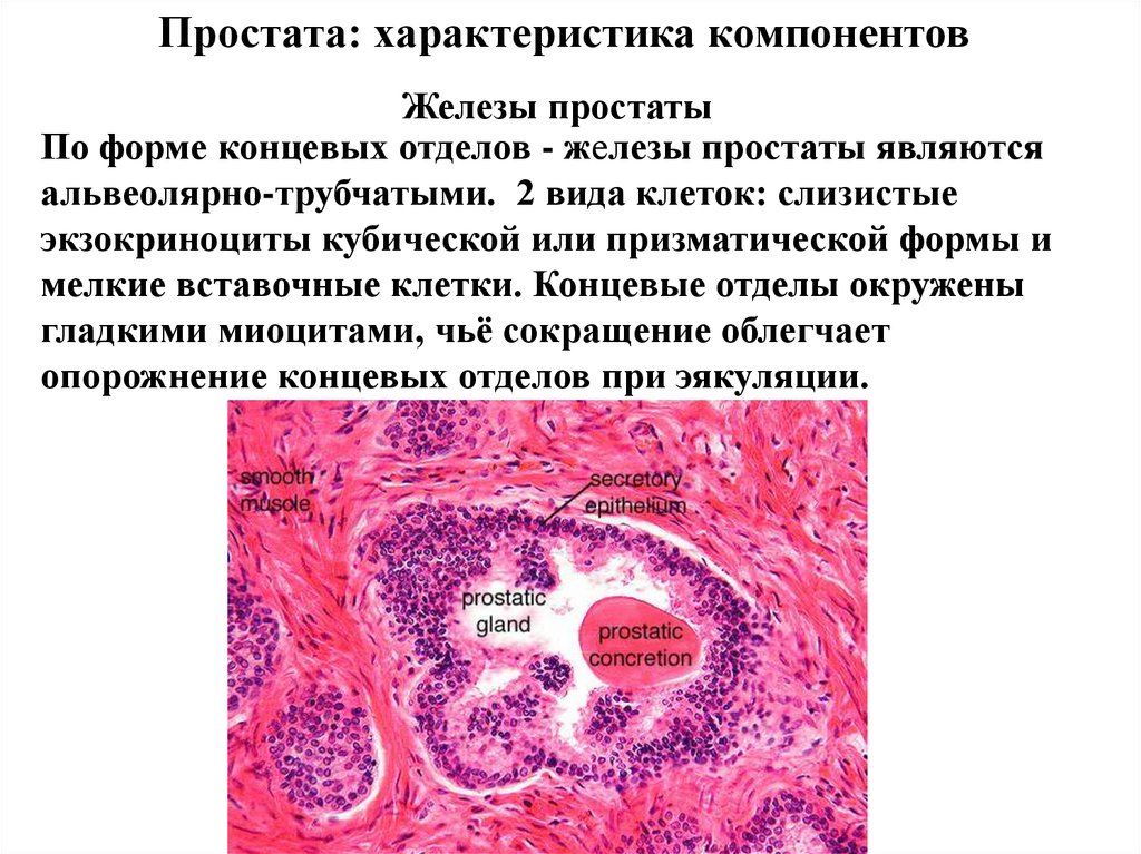 Простата у человека. Предстательная железа гистология. Гистологическое строение предстательной железы. Клетки концевых отделов простаты. Гипертрофия предстательной железы гистология.