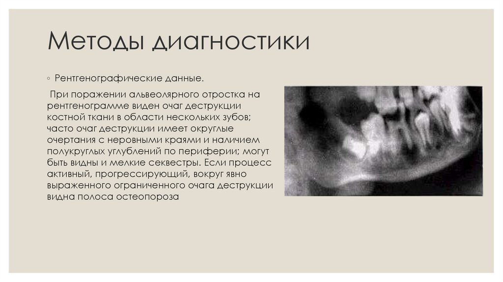 Методы диагностики