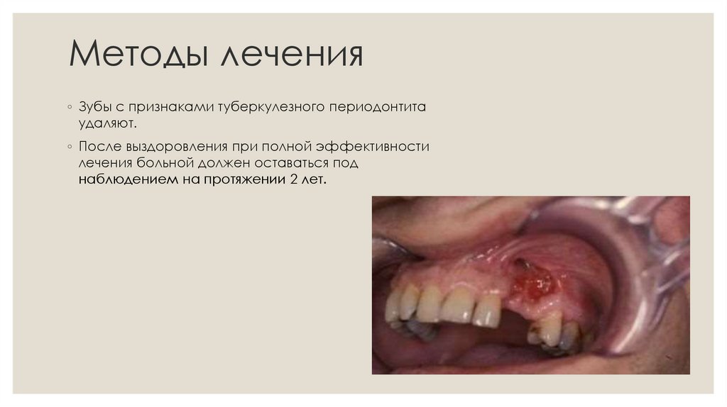 Методы лечения