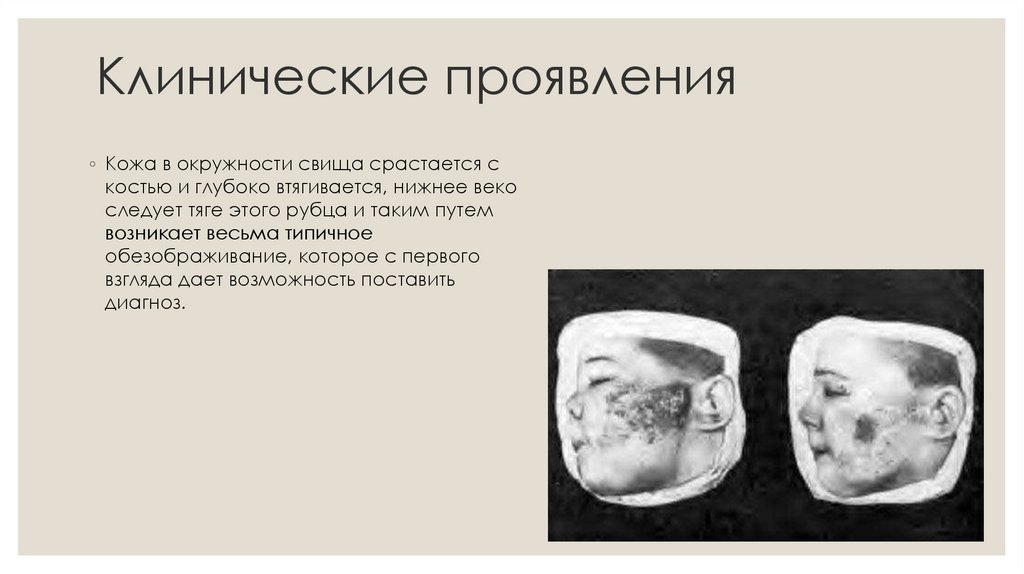 Клинические проявления